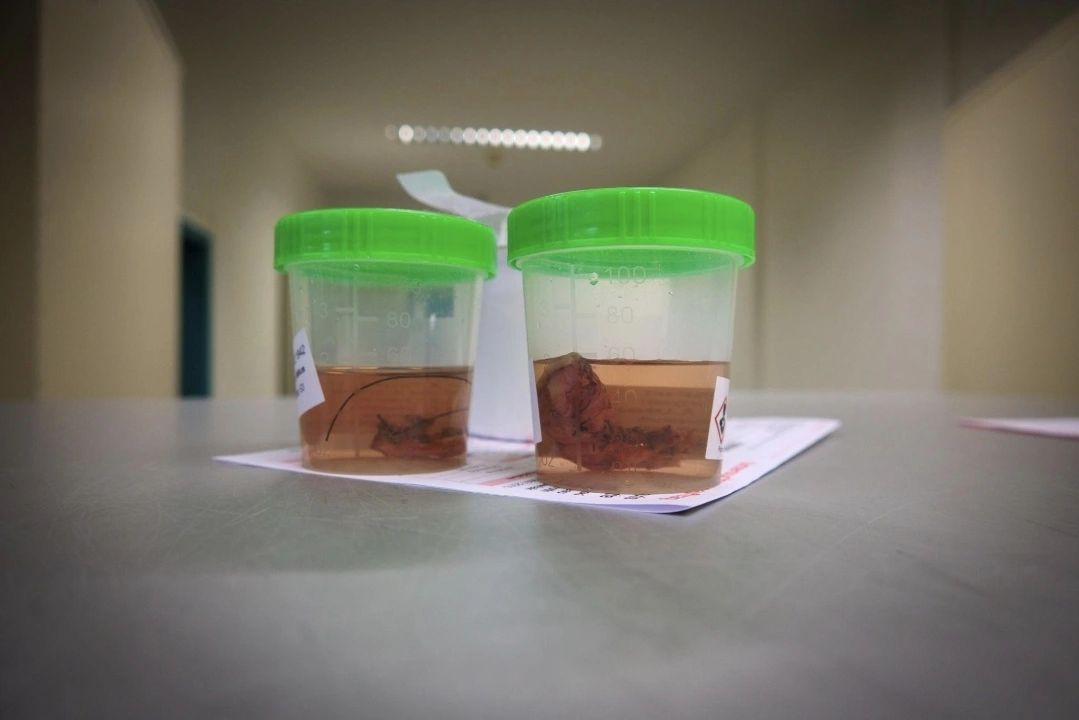 Safety and ventilation for formalin use