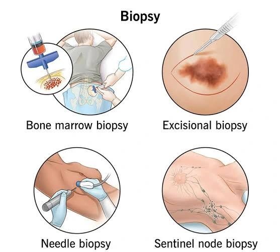 Journey of a tissue sample